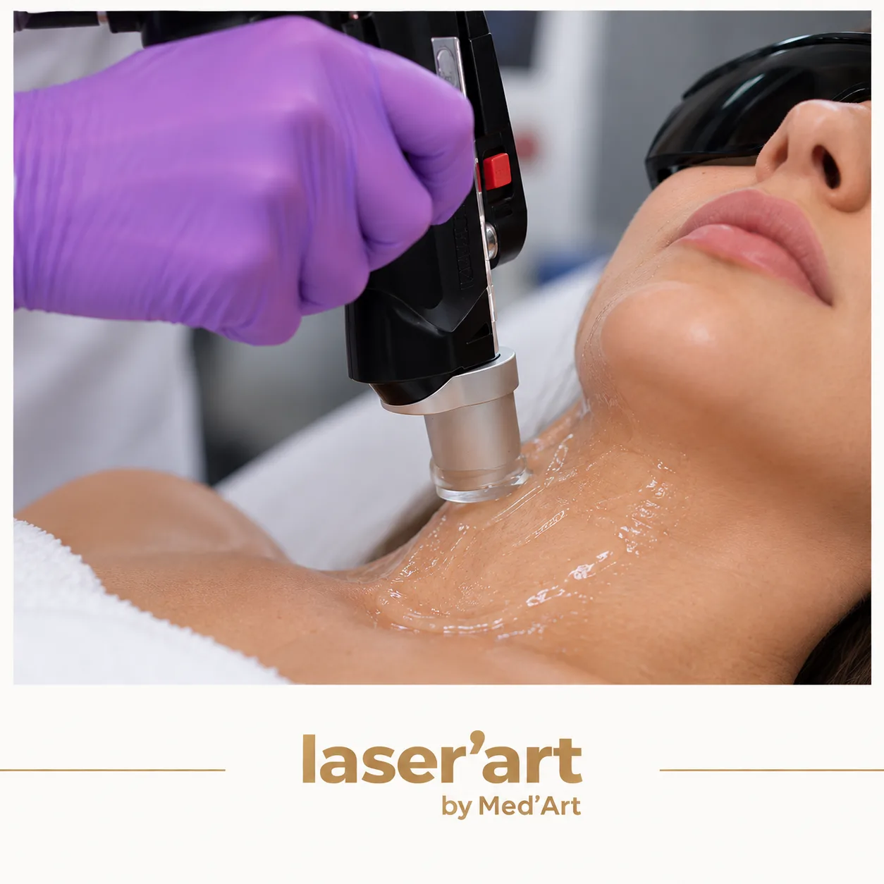 Epilare definitiva cluj - Laser'Art