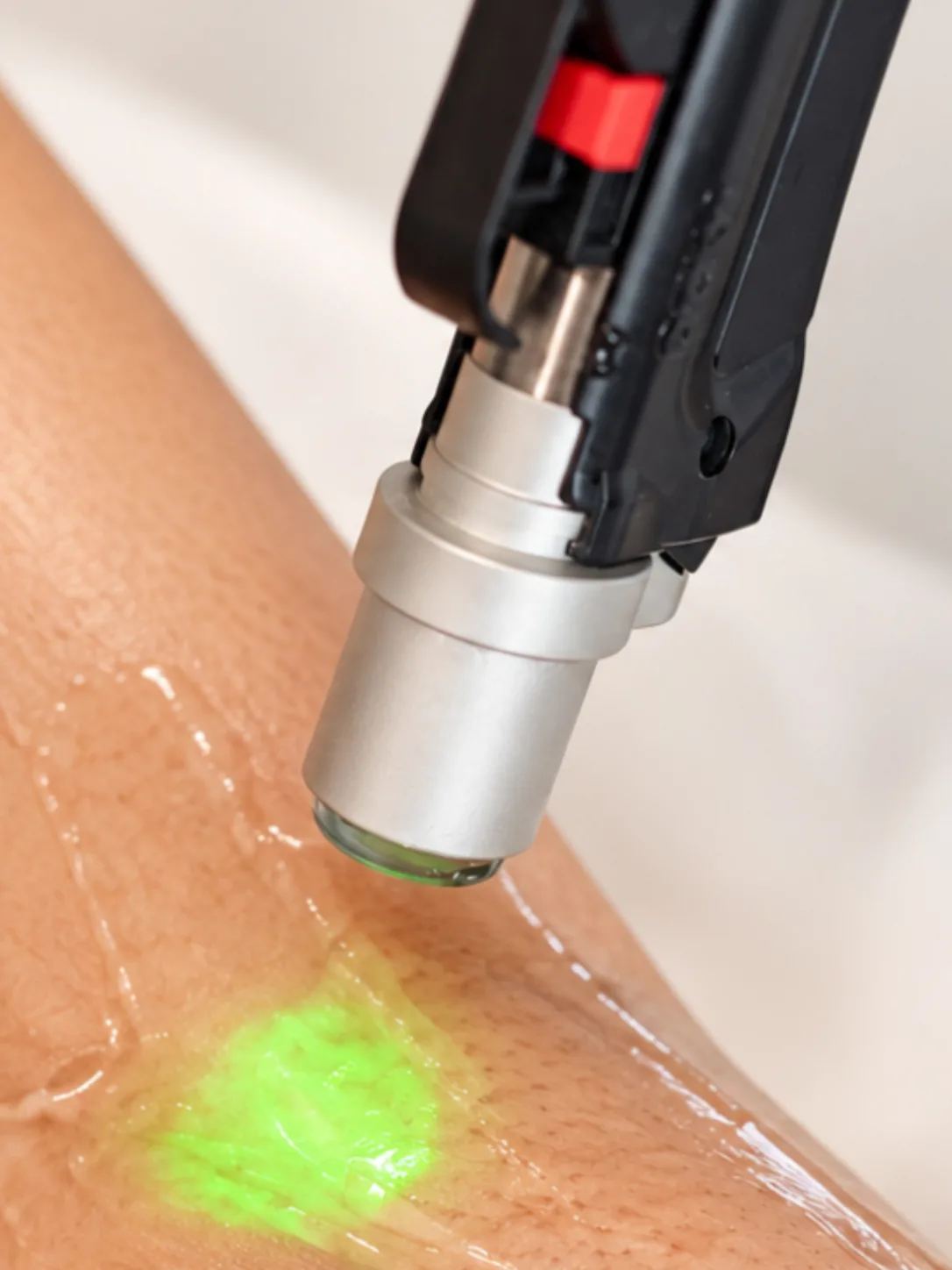Epilare Definitiva Cluj Laser'Art