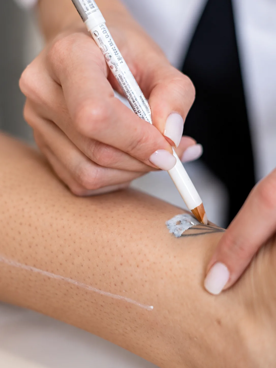 Epilare Definitiva Cluj Laser'Art