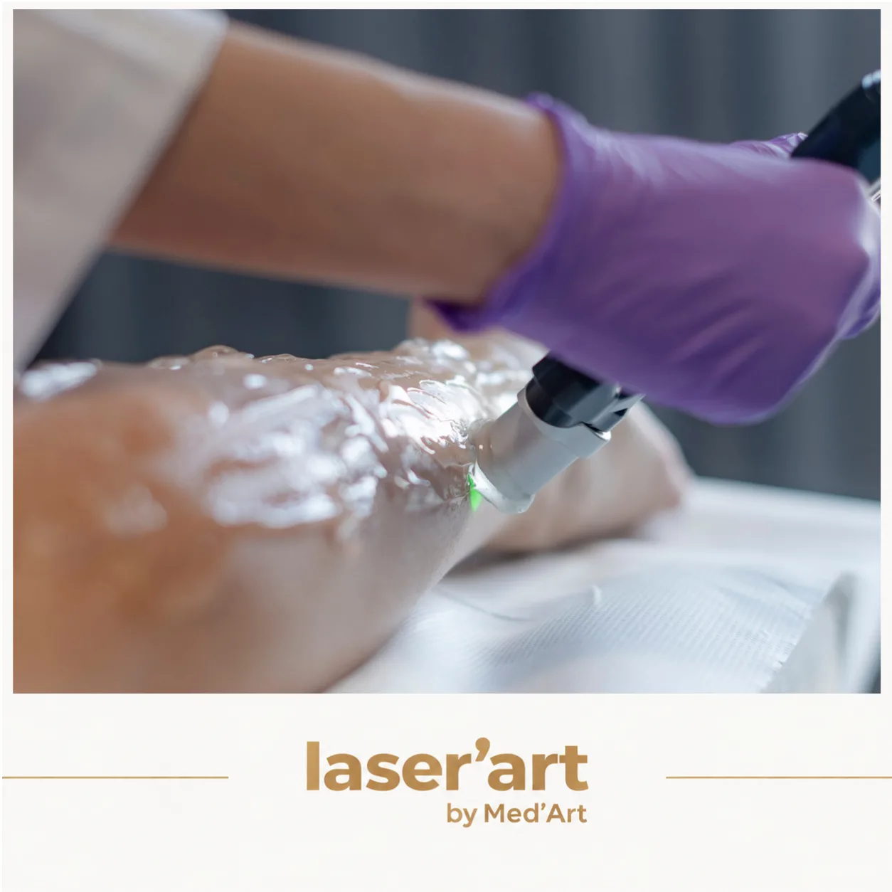 Epilare definitiva cluj - Laser'Art